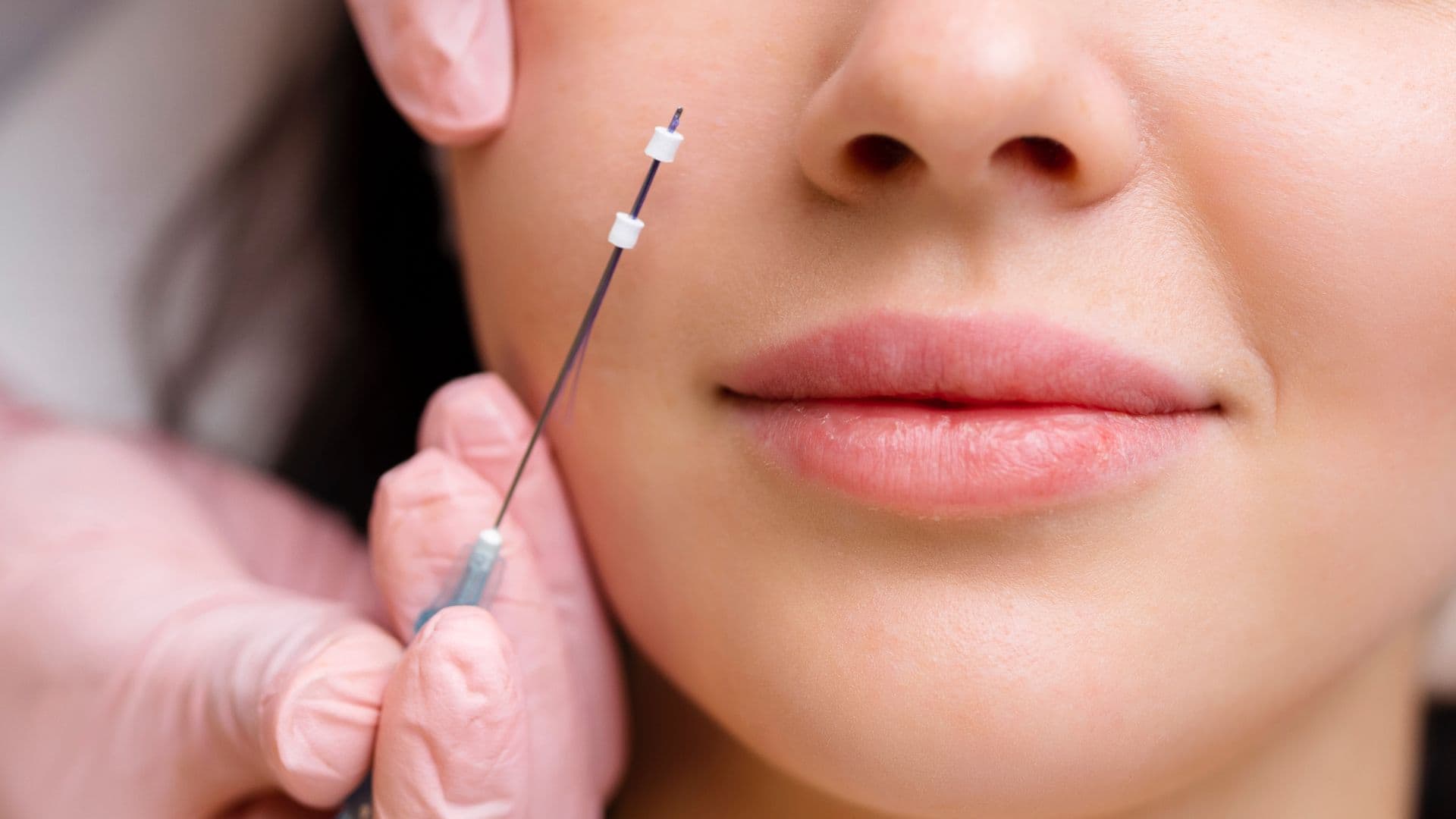 Hilos Tensores: El secreto de un rejuvenecimiento facial sin cirugía